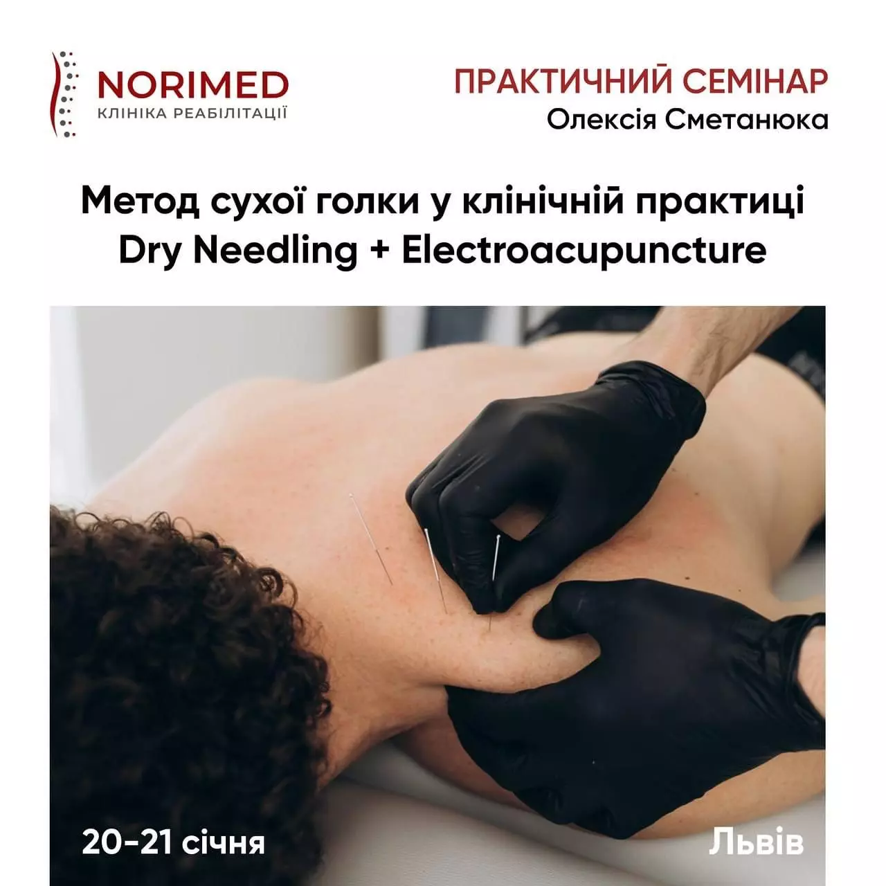 Банер для практичного семінару метода сухої голки та електроакупунктури