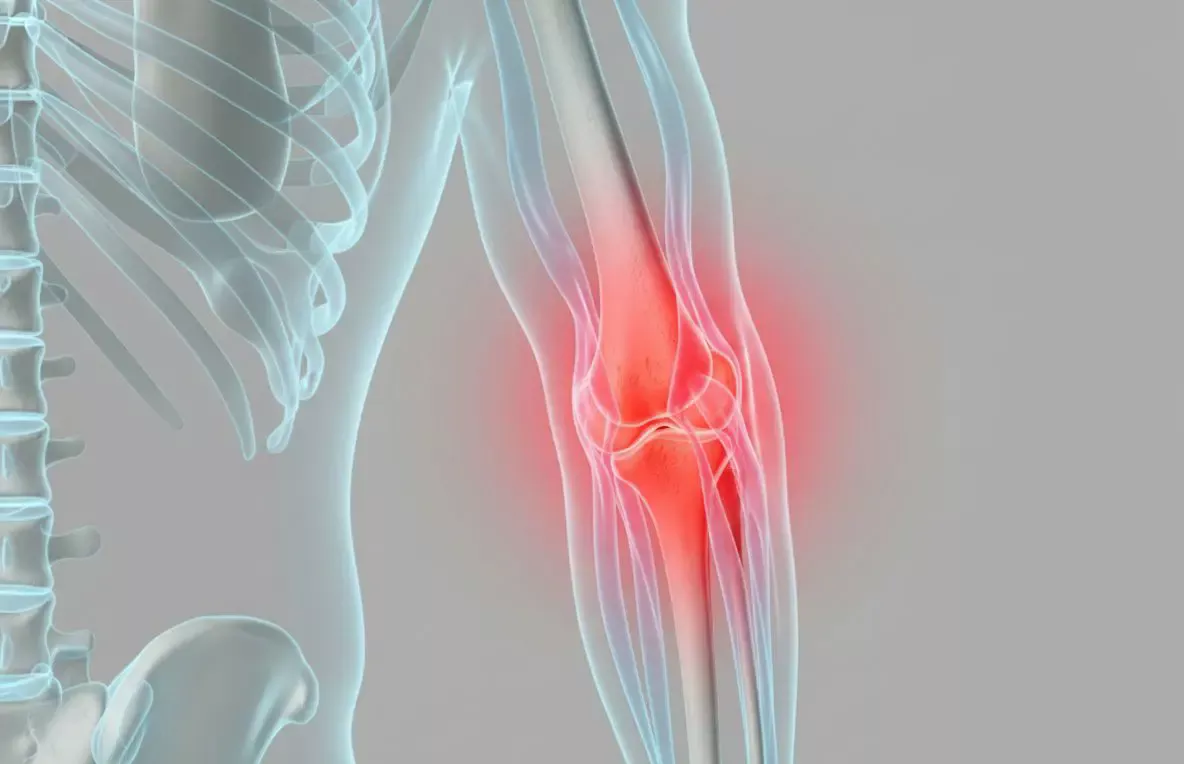 Ілюстрація ліктьового суглоба