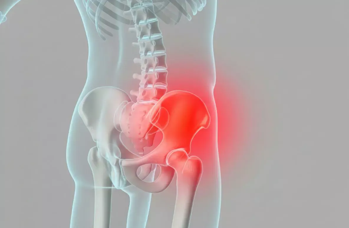 Ілюстрація кульшового суглоба